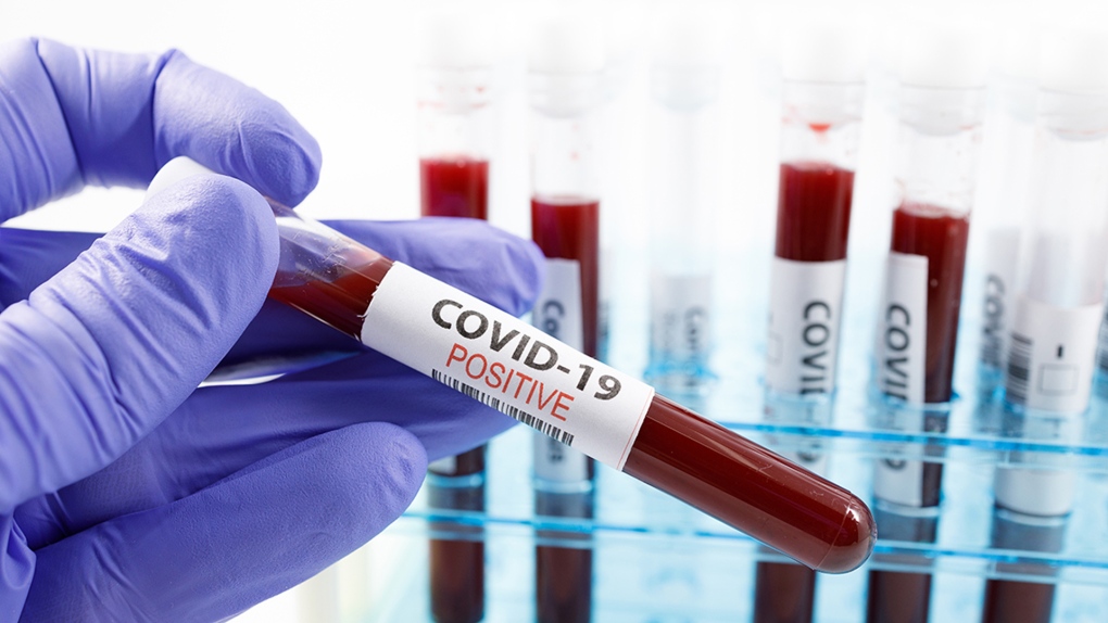 NPHF has been regularly updating the COVID-19 cases showing its trends in Nepal. NPHF has been regularly updating the COVID-19 cases showing its trends in Nepal.